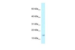 RPP21 Rabbit anti-Human, Polyclonal, Novus Biologicals 0.1 mL | Buy Online | Novus Biologicals | Fisher Scientific